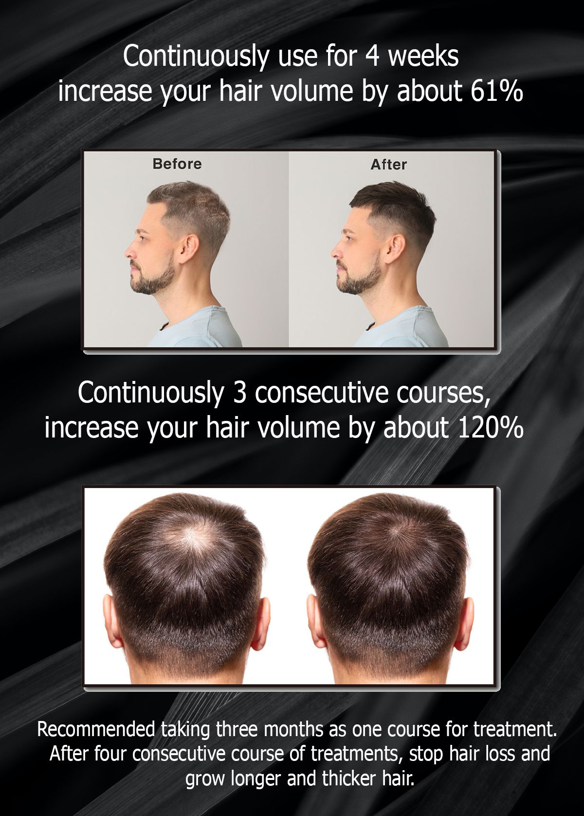 Hair Regaining Super Growth Extract Hair Regaining Super Growth Extract